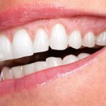 Parodontite: Cos’è e come riconoscerla